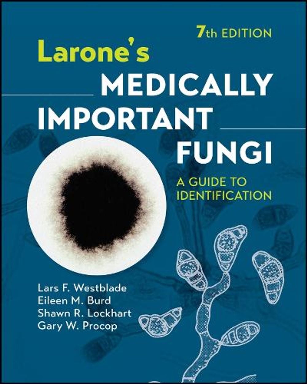 Larone's Medically Important Fungi, 7th Edition by Lars F. Westblade - ISBN: 9781683674405