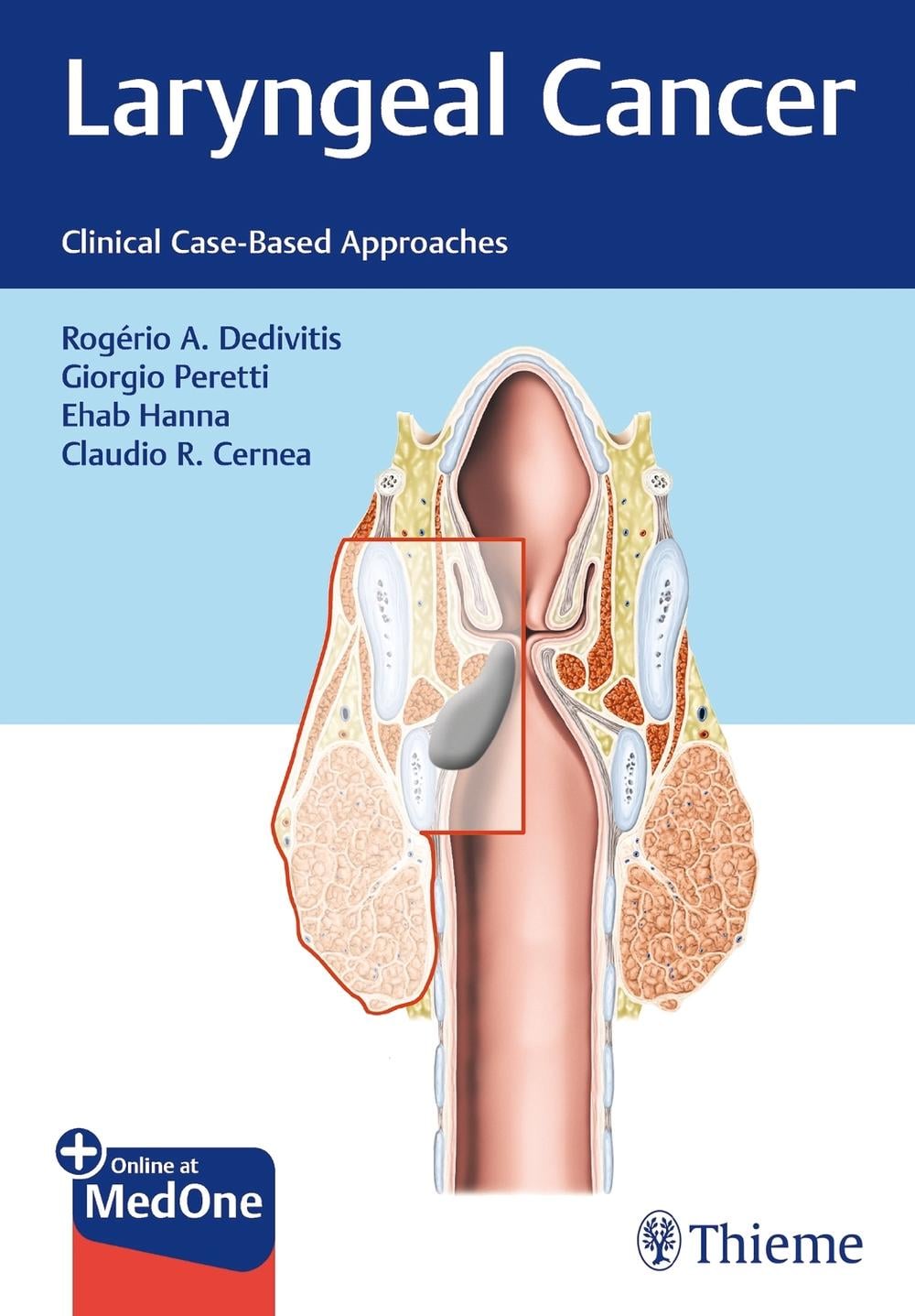 Laryngeal Cancer by Giorgio Peretti - ISBN: 9781684200016