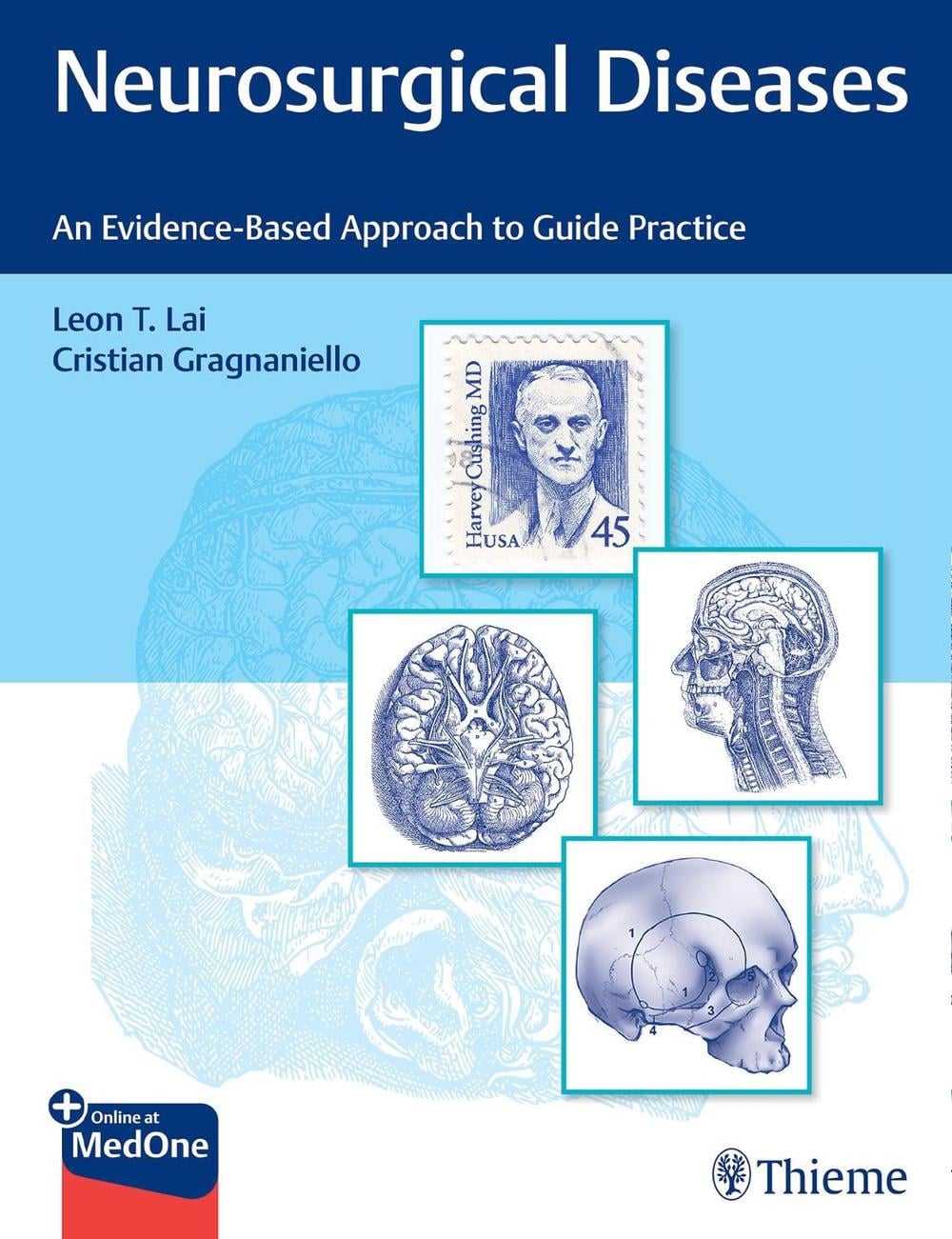 Neurosurgical Diseases by Leon Lai - ISBN: 9781684200511