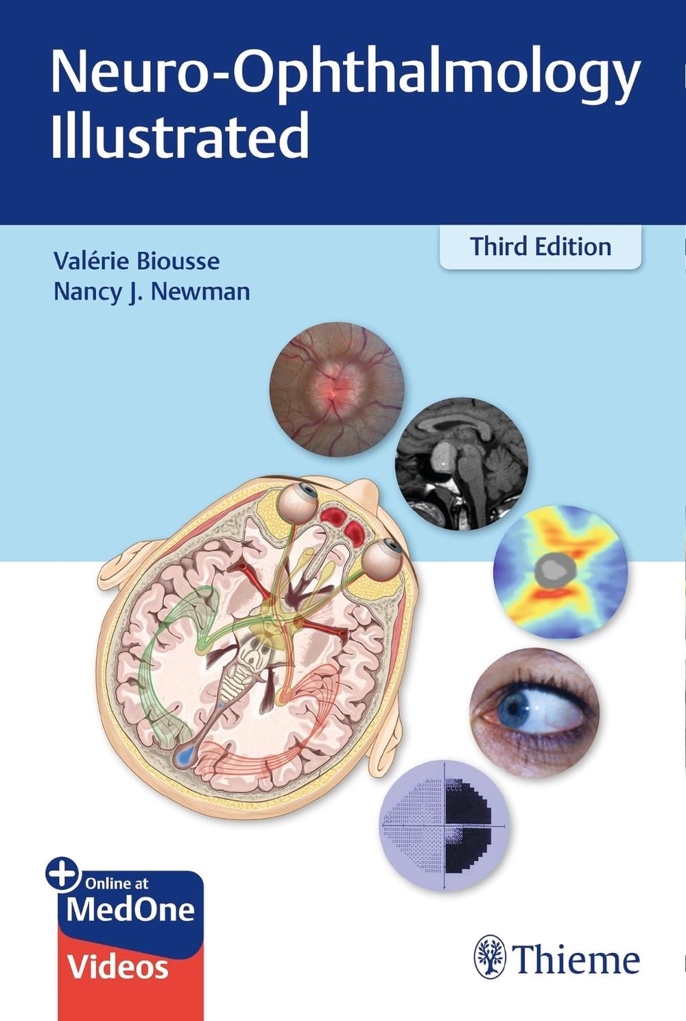 Neuro-Ophthalmology Illustrated by Valerie Biousse - ISBN: 9781684200740