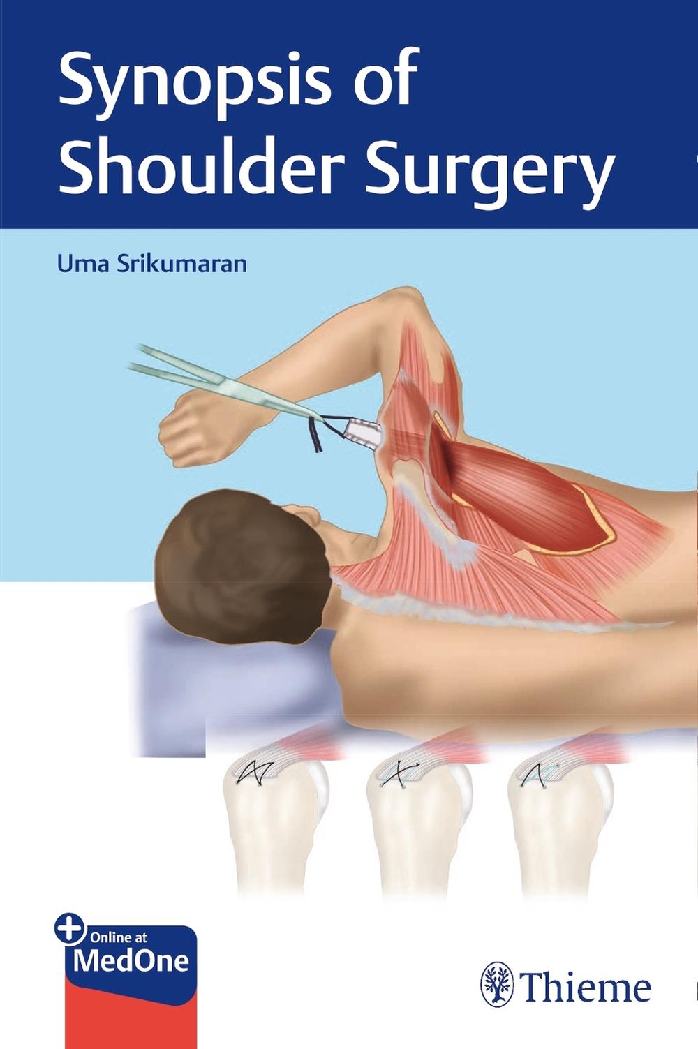 Synopsis of Shoulder Surgery, 9781684200801