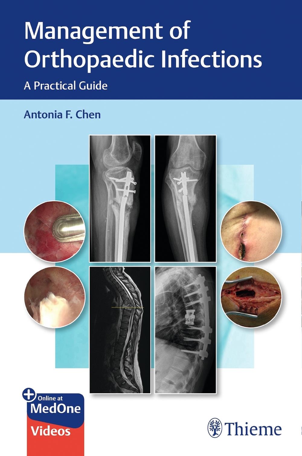 Management of Orthopaedic Infections, 9781684201334