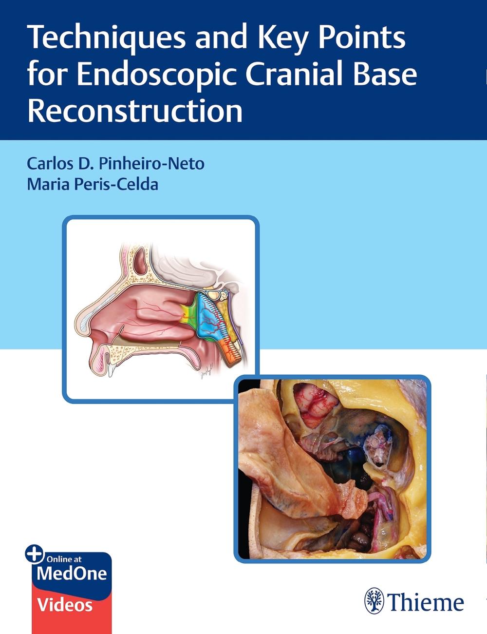 Techniques and Key Points for Endoscopic Cranial Base Reconstruction, 9781684202324