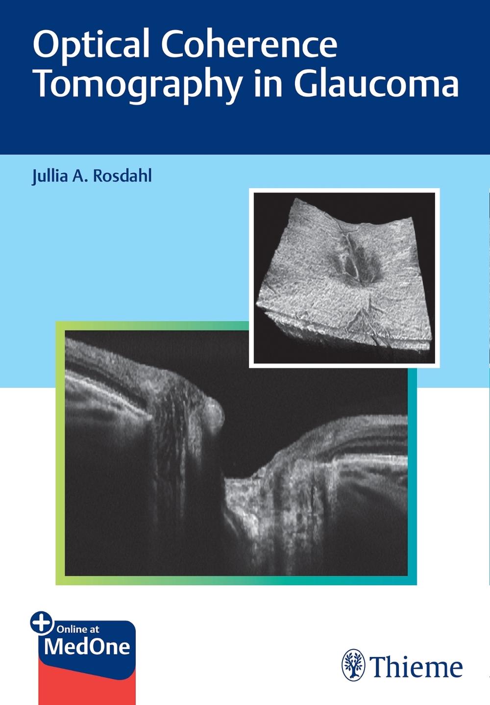 Optical Coherence Tomography in Glaucoma by Jullia Rosdahl - ISBN: 9781684202478