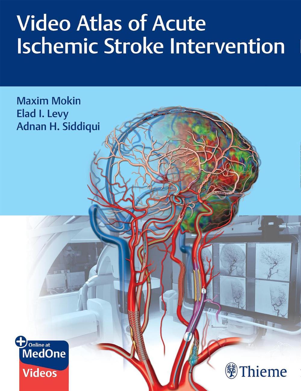 Video Atlas of Acute Ischemic Stroke Intervention by Maxim Mokin - ISBN: 9781684202492
