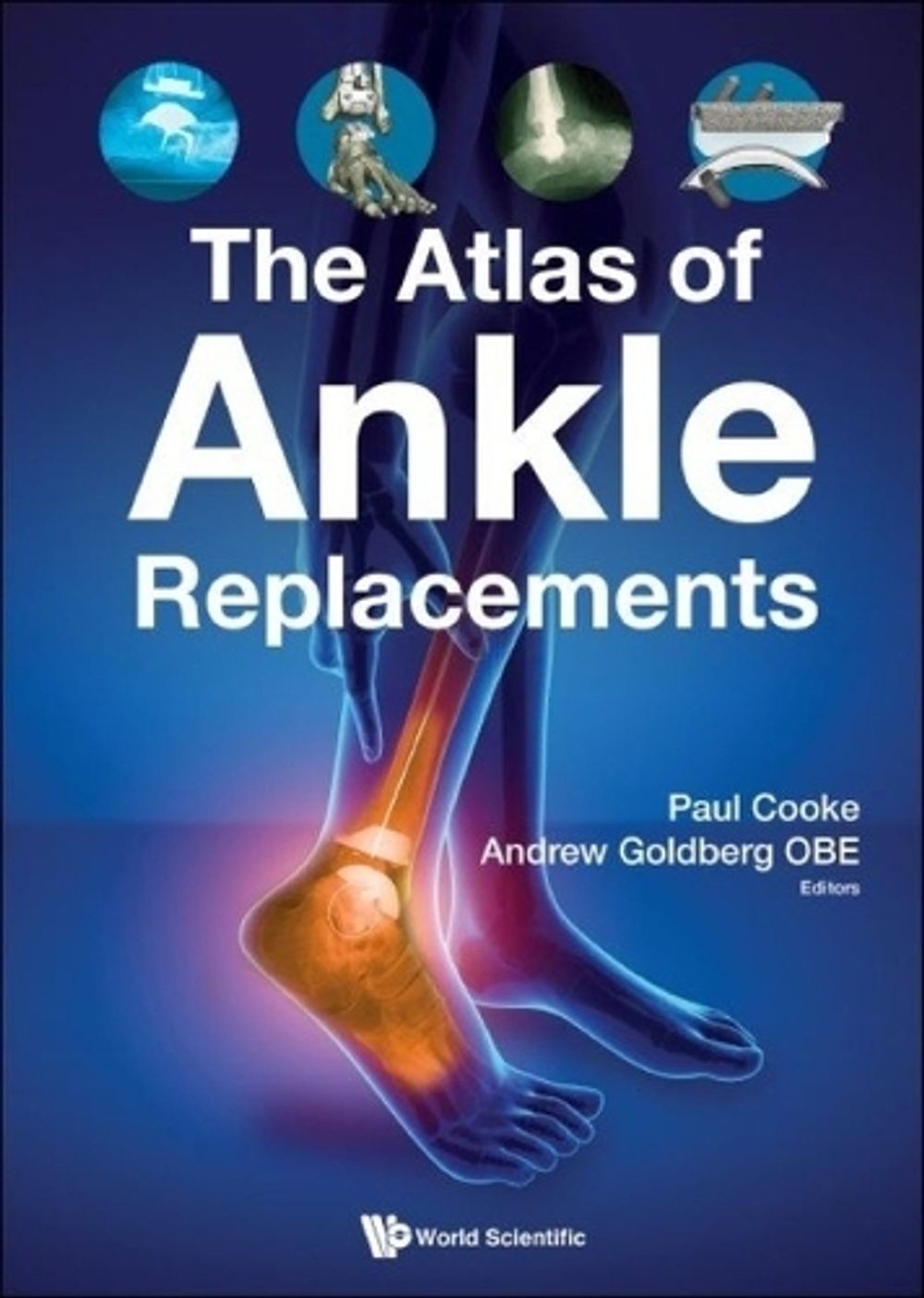 Atlas Of Ankle Replacements, The by Andrew Goldberg - ISBN: 9781786346230