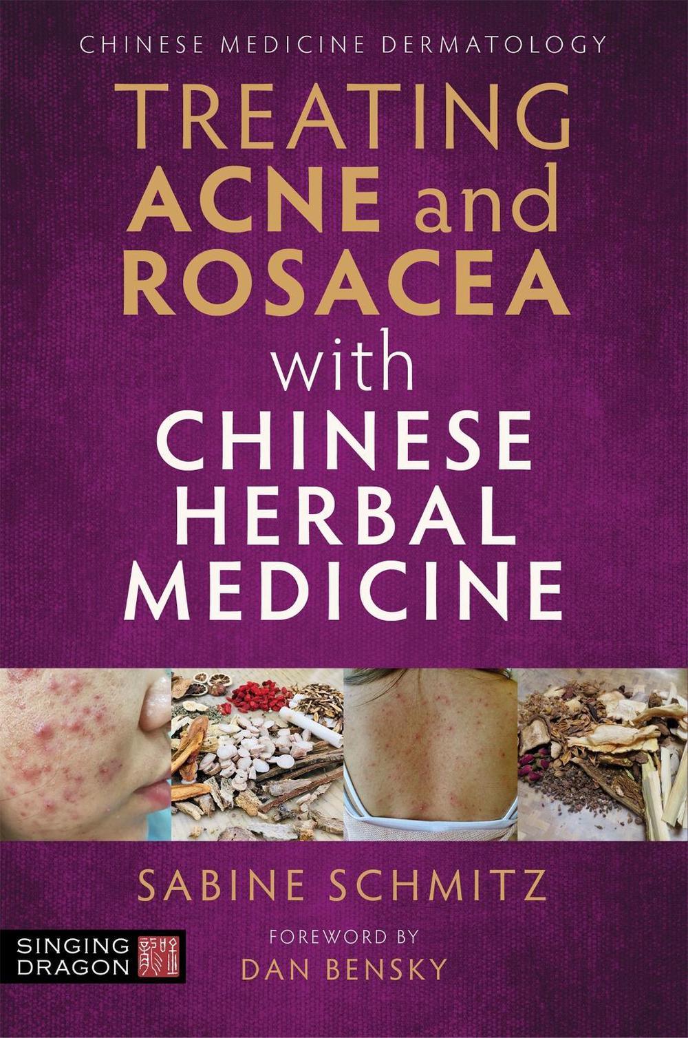 Treating Acne and Rosacea with Chinese Herbal Medicine, 9781787752276