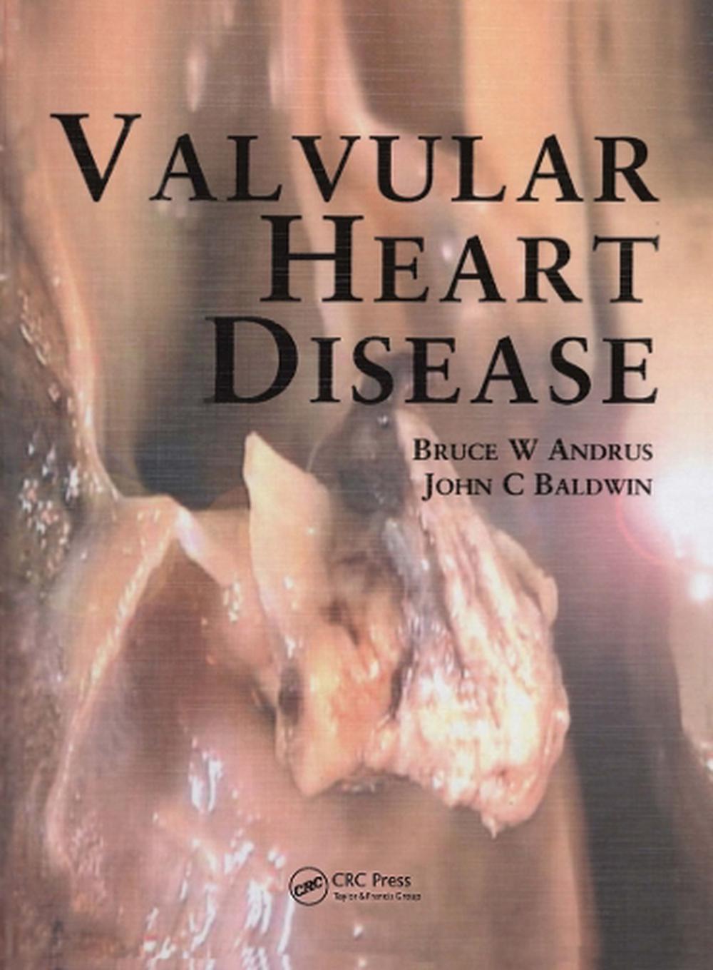 Valvular Heart Disease, 9781840760583