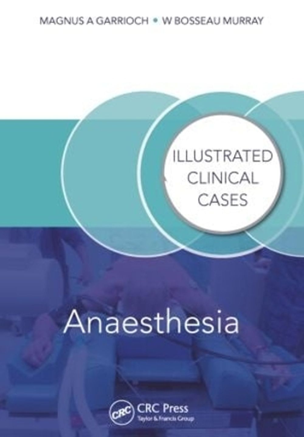 Anaesthesia by Magnus Garrioch - ISBN: 9781840760774