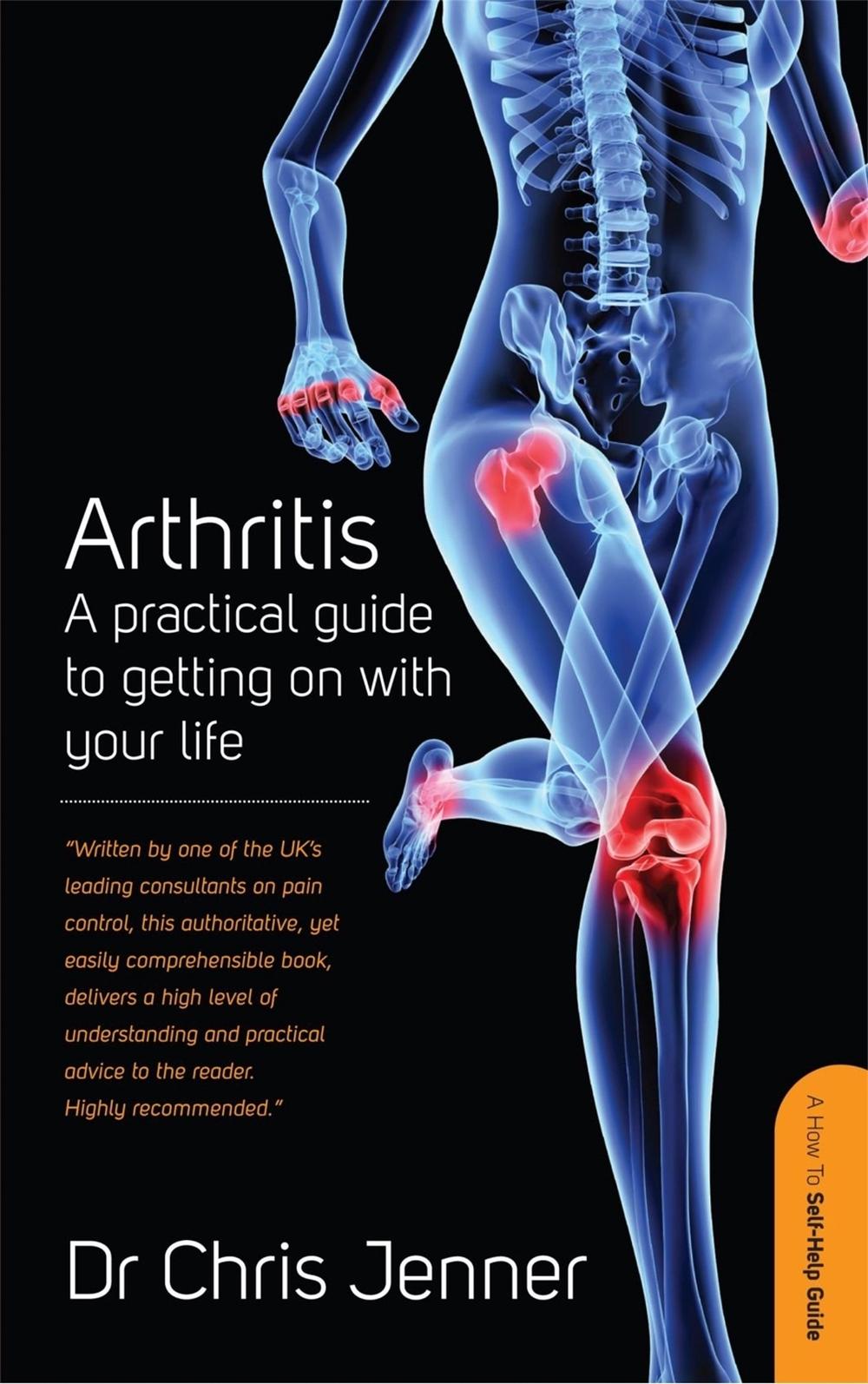 Arthritis by Chris Jenner - ISBN: 9781845284718