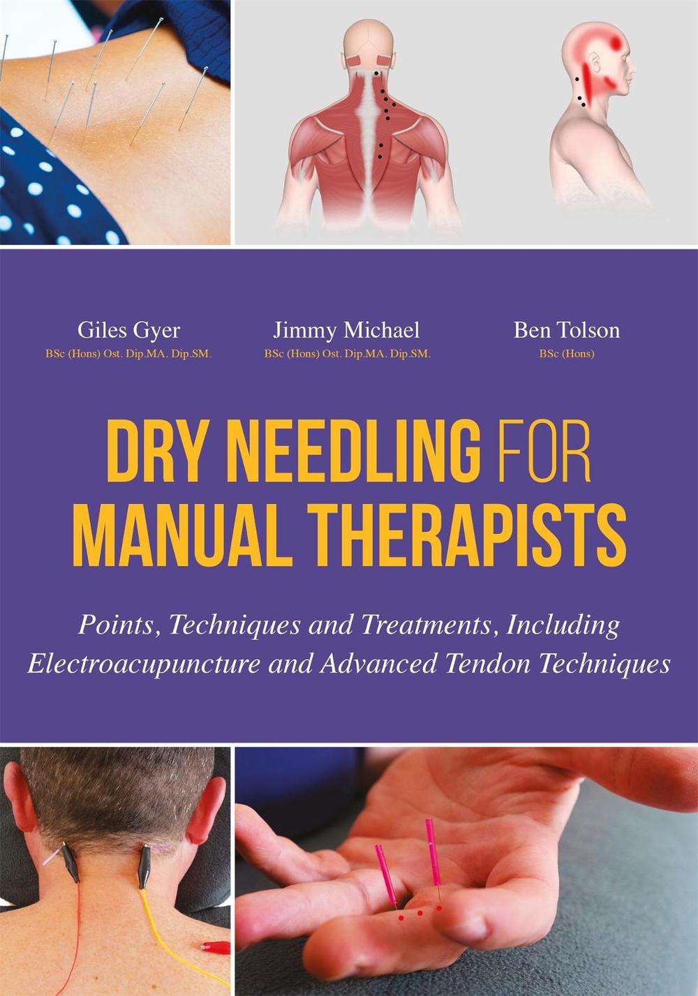 Dry Needling for Manual Therapists, 9781848192553