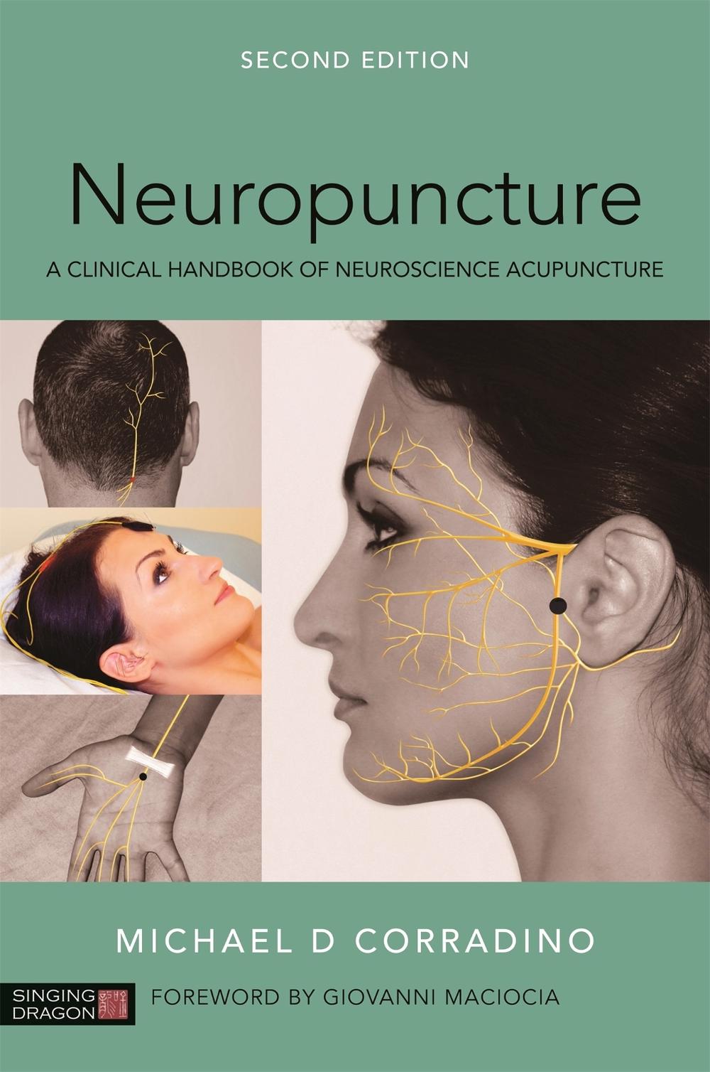Neuropuncture, 9781848193314