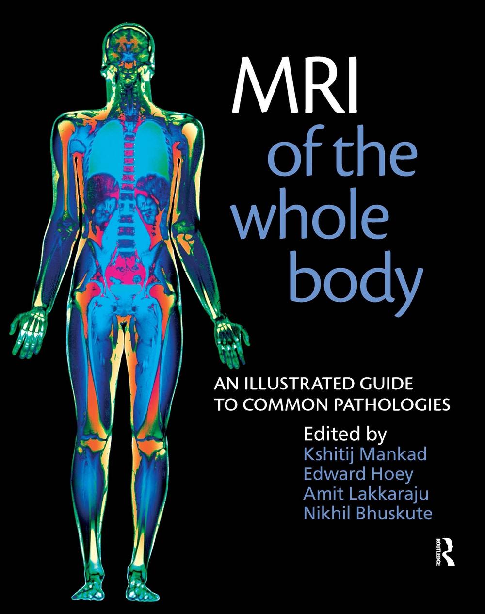 MRI of the Whole Body, 9781853157769