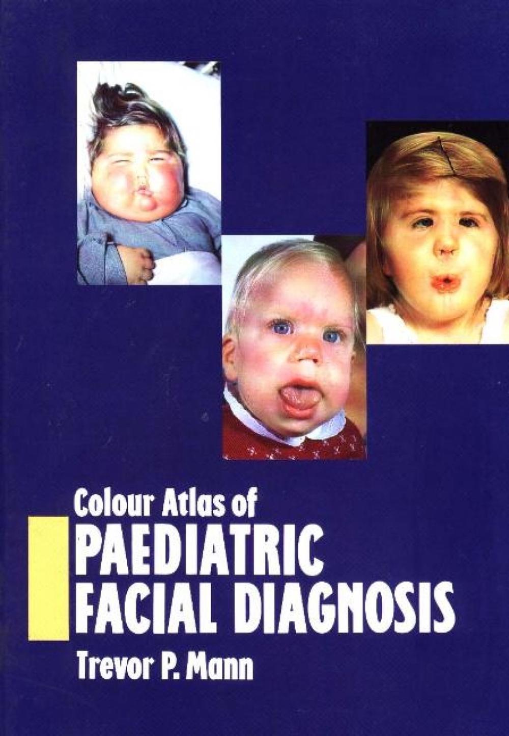 Colour Atlas of Paediatric Facial Diagnosis, 9781854570017