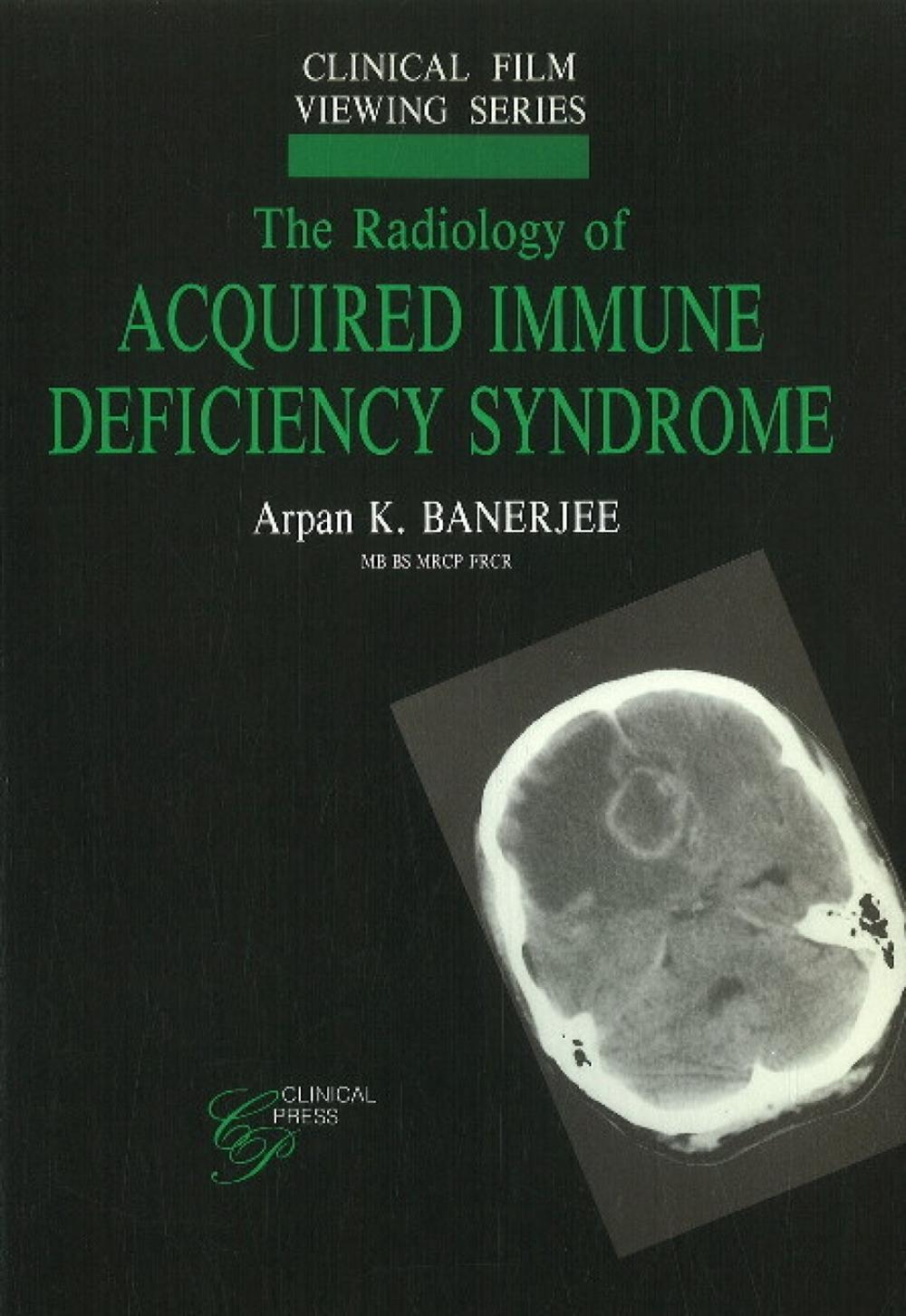 Radiology of Acquired Immune Deficiency Syndrome, 9781854570253