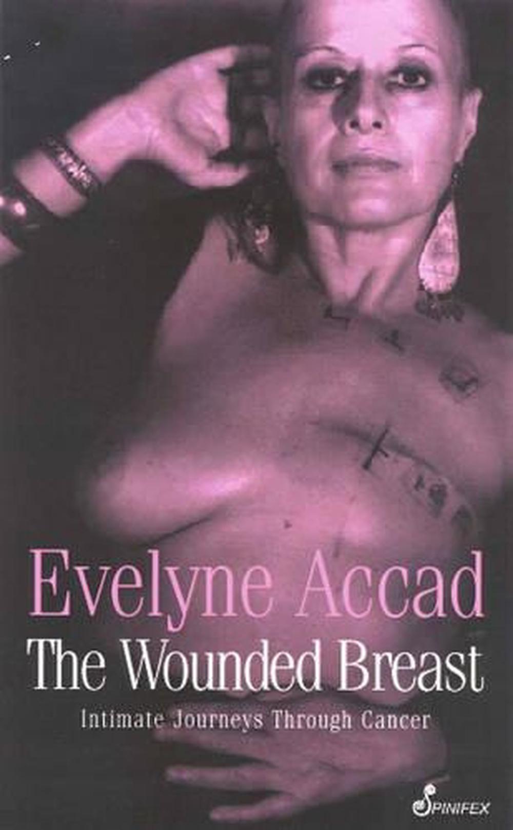 The Wounded Breast, 9781876756123