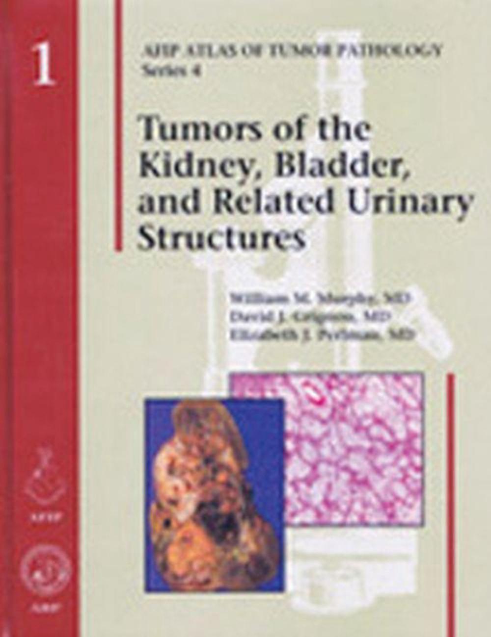 Tumors of the Kidney, Bladder, and Related Urinary Structures, 9781881041887