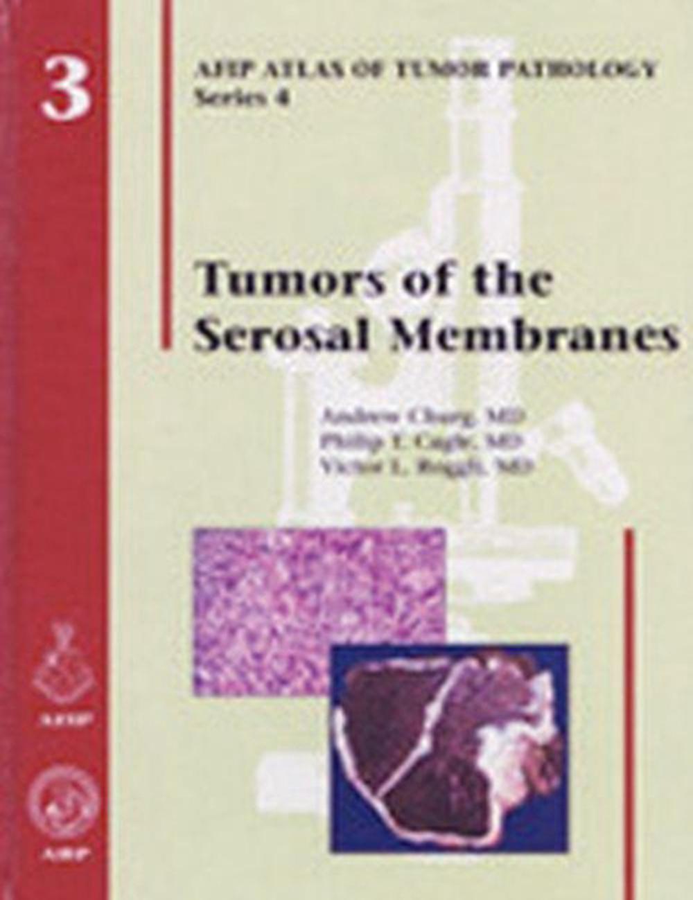 Tumors of the Serosal Membranes, 9781881041979