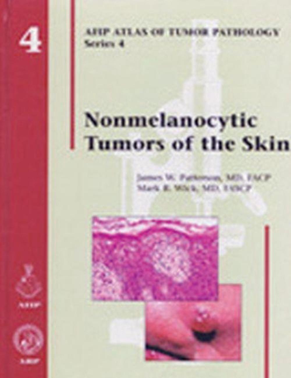 Nonmelanocytic Tumors of the Skin by James W. Patterson - ISBN: 9781881041986