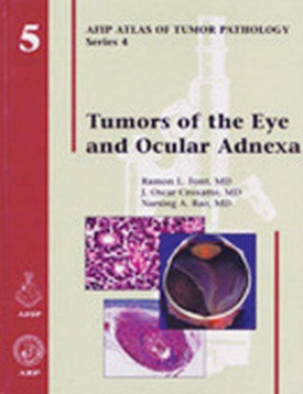 Tumors of the Eye and Ocular Adnexa, 9781881041993