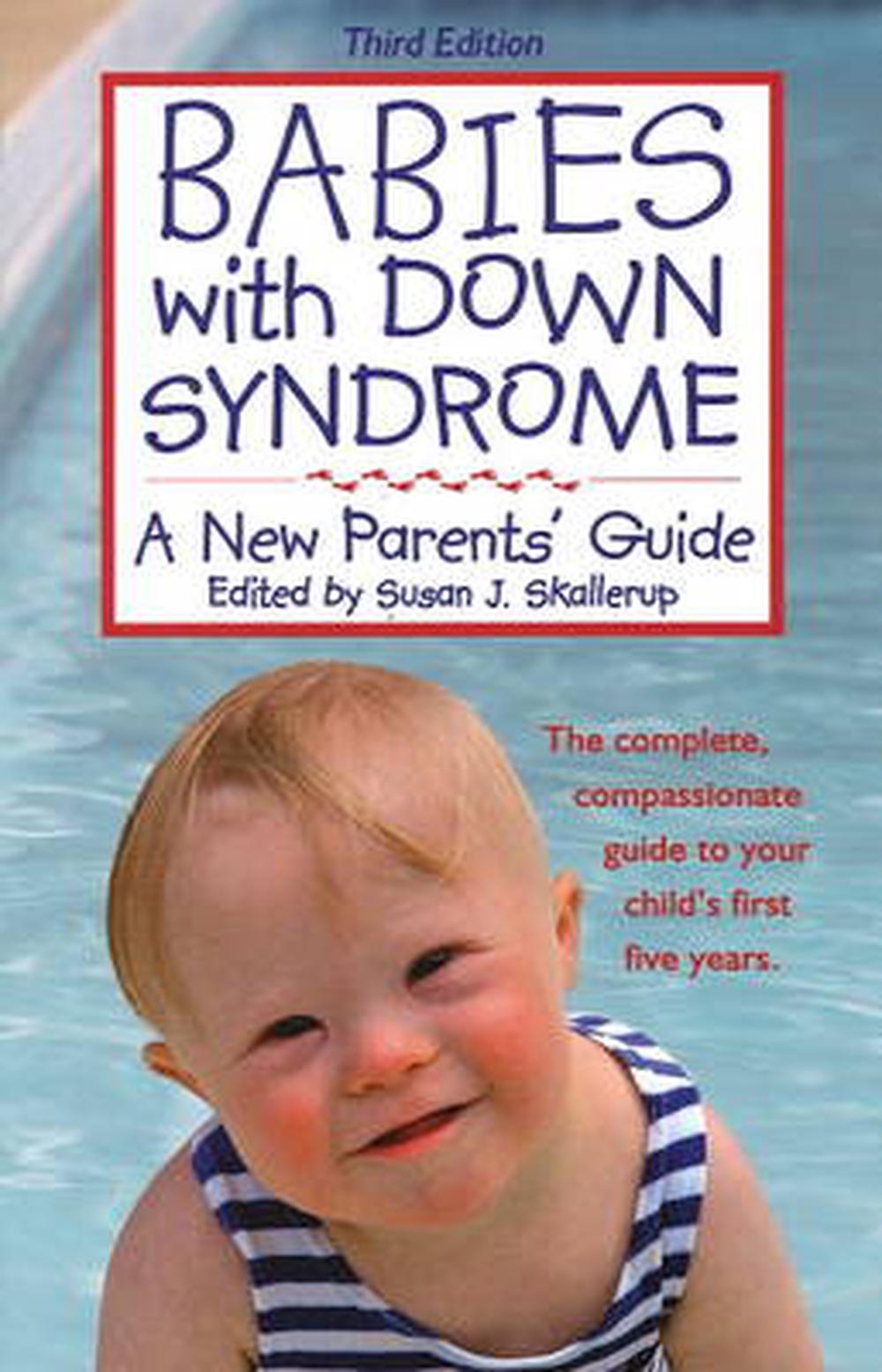 Babies with Down Syndrome A New Parents' Guide by Susan J Skallerup