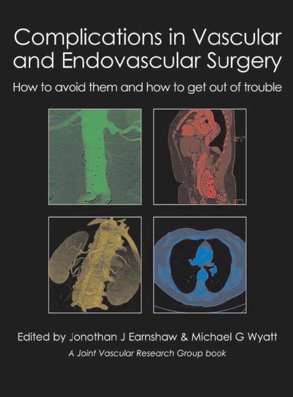 Complications in Vascular and Endovascular Surgery by Dr Jonothan J. Earnshaw - ISBN: 9781903378809