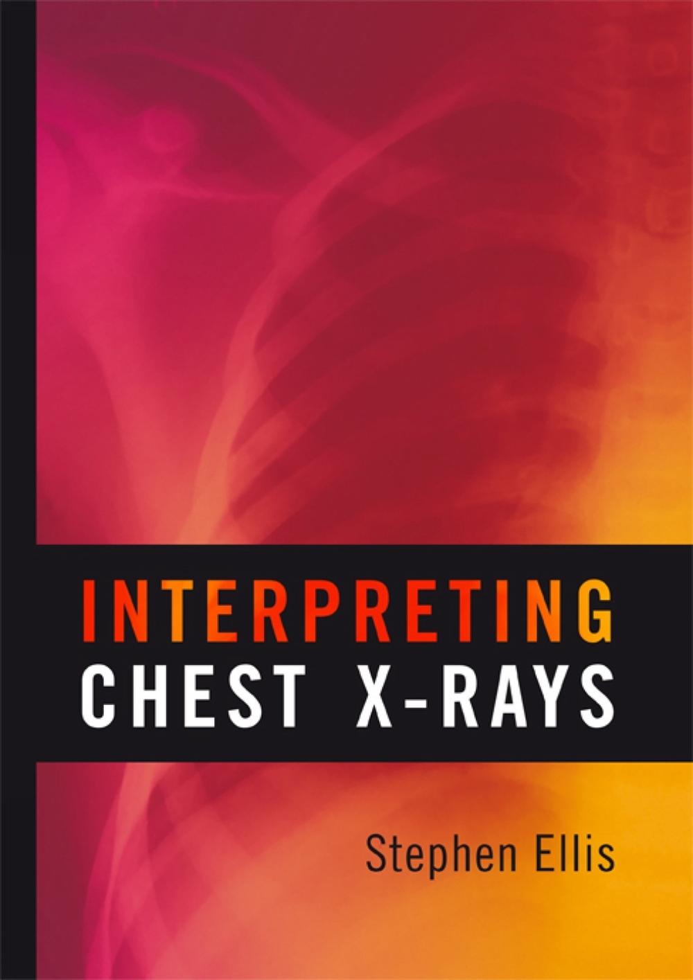 Interpreting Chest X-Rays, 9781904842774