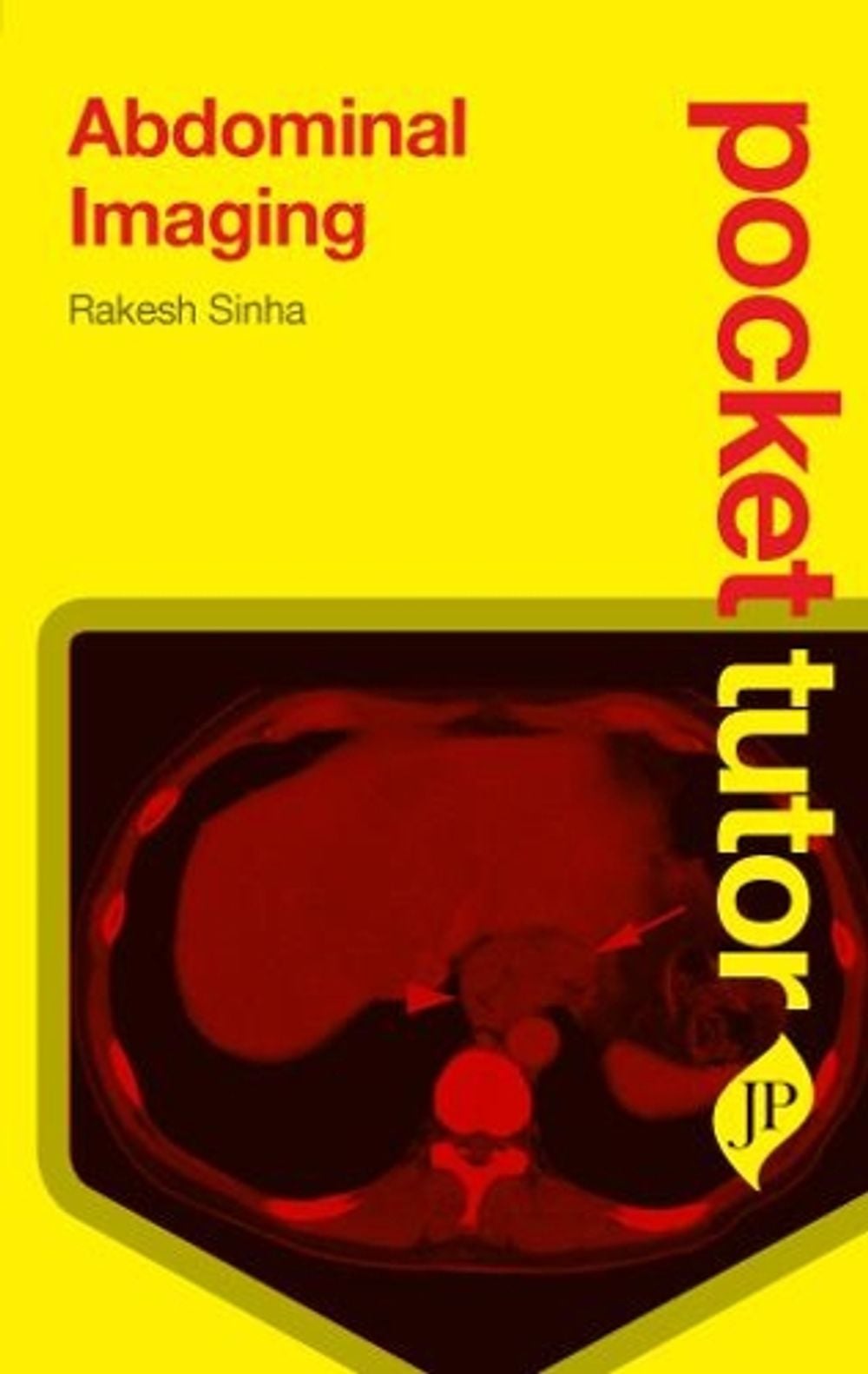 Pocket Tutor Abdominal Imaging by Rakesh Sinha - ISBN: 9781907816048