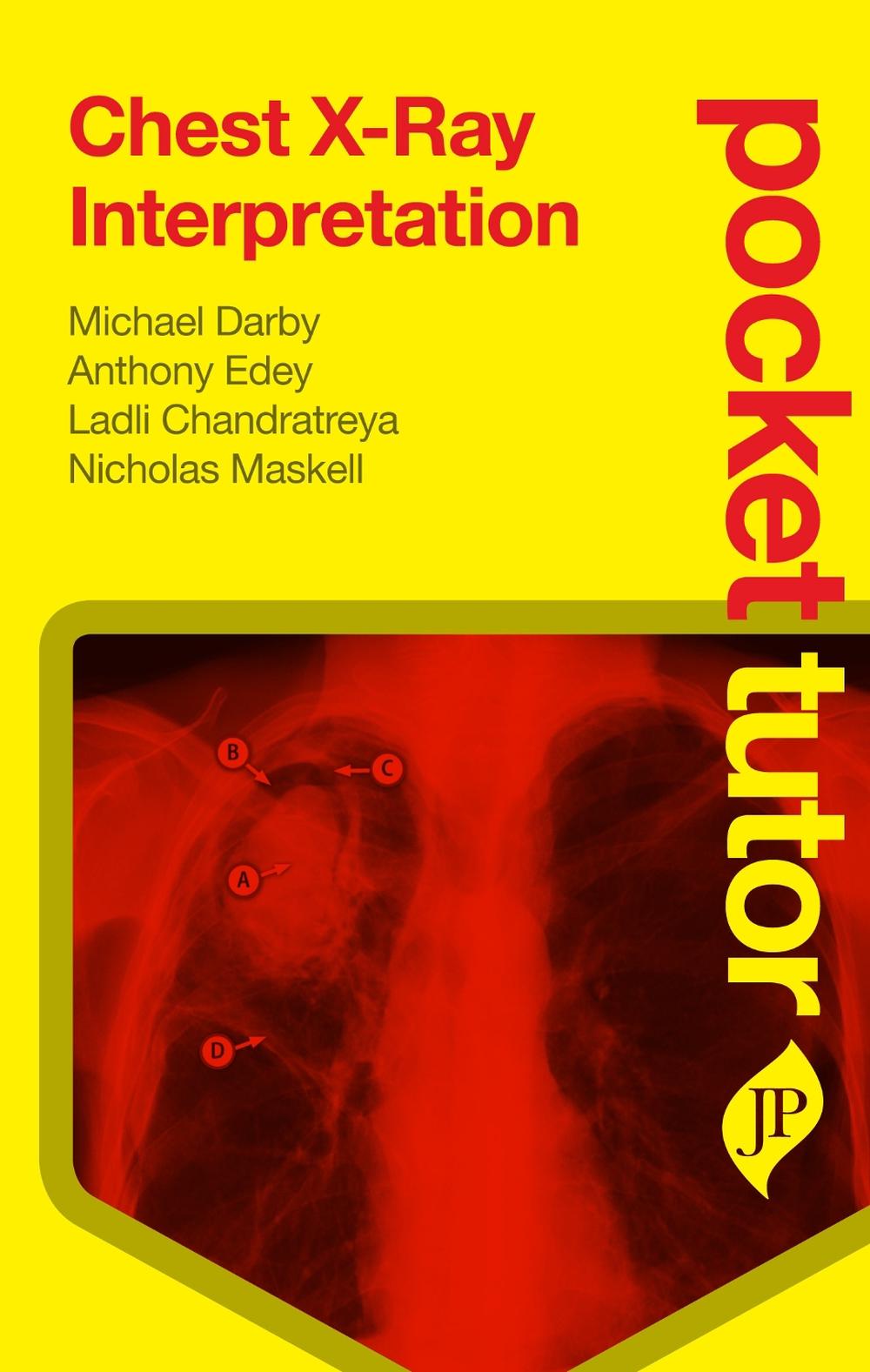 Pocket Tutor Chest X-Ray Interpretation, 9781907816062