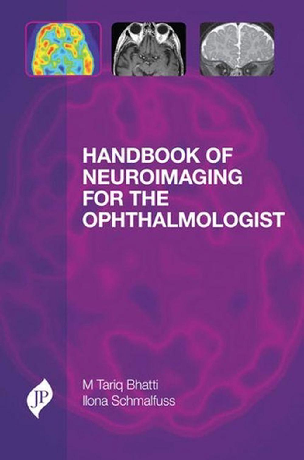 Handbook of Neuroimaging for the Ophthalmologist, 9781907816130