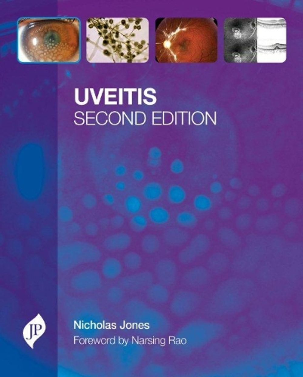 Uveitis, 2nd Edition by Nicholas P. Jones - ISBN: 9781907816185