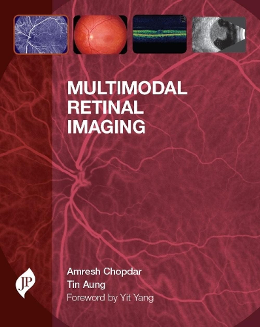 Multimodal Retinal Imaging by Amresh Chopdar - ISBN: 9781907816604