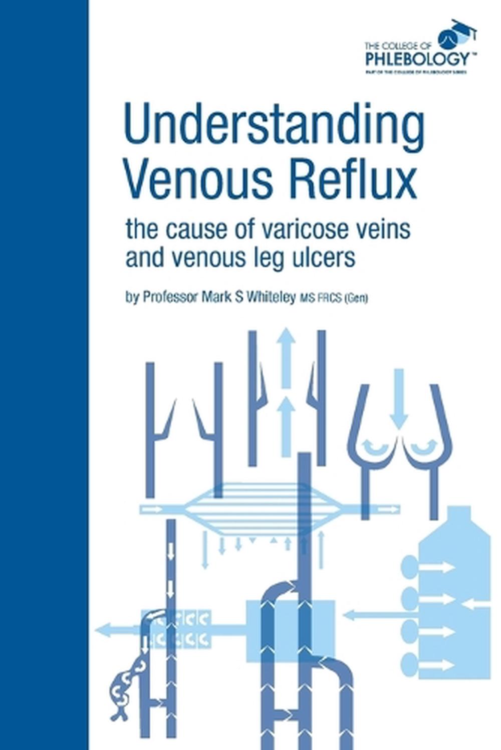 Understanding Venous Reflux the Cause of Varicose Veins and Venous Leg Ulcers, 9781908586001