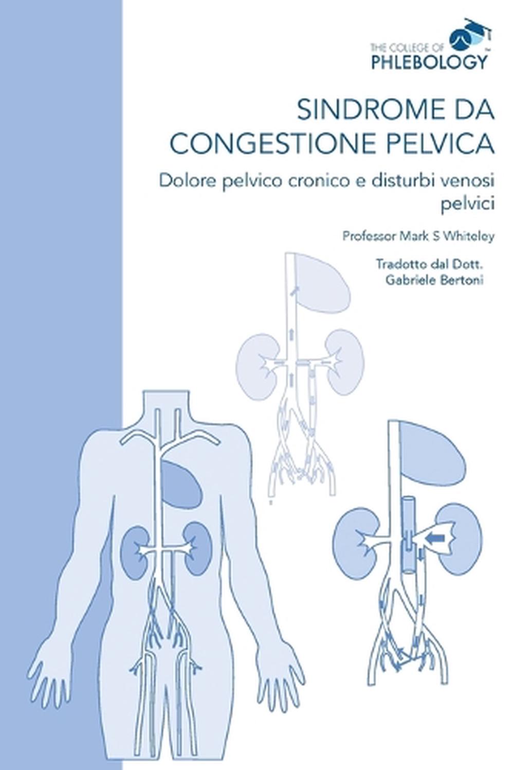 Sindrome da congestione pelvica - Dolore pelvico cronico e disturbi venosi pelvici, 9781908586131