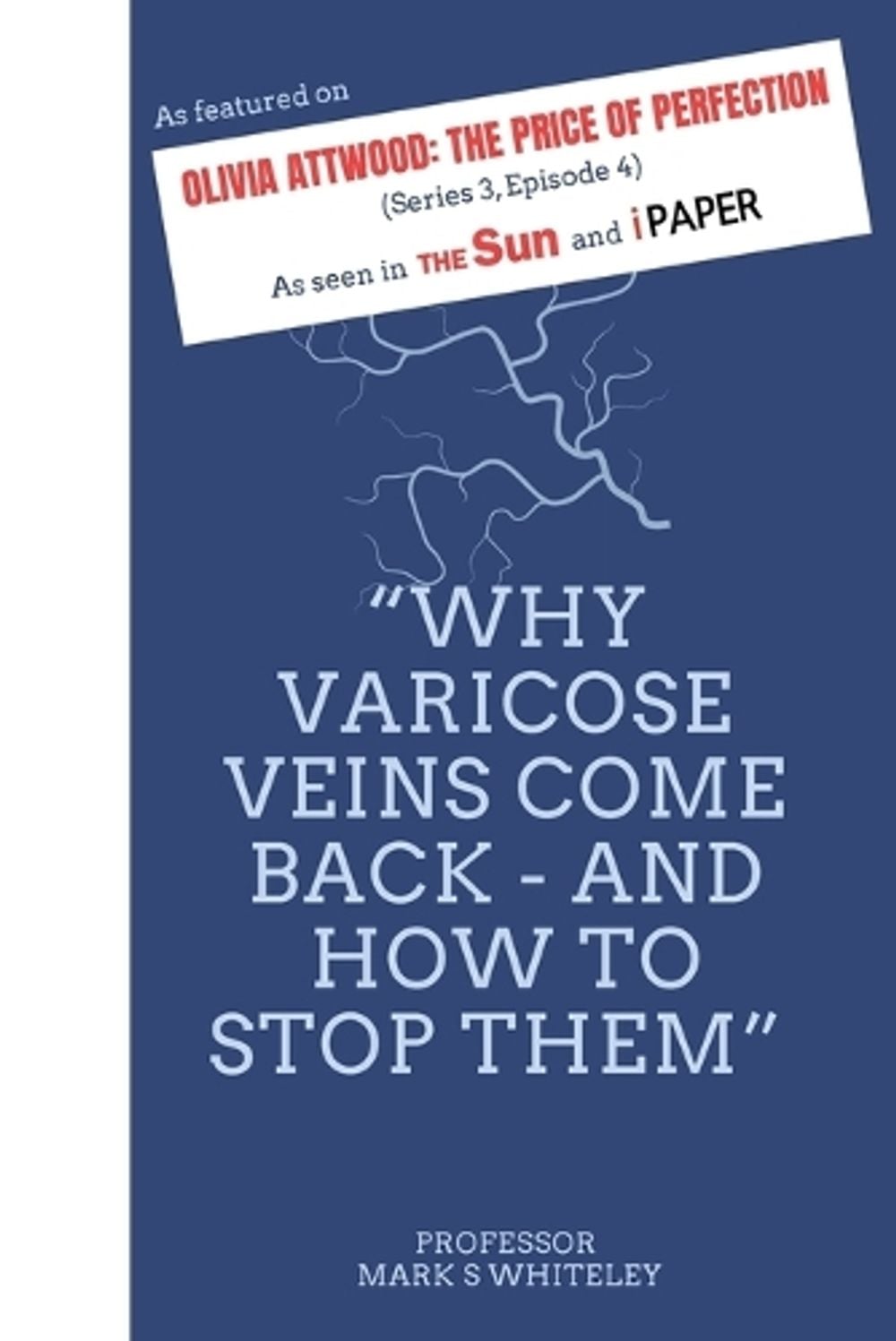 Why Varicose Veins Come Back – and How to Stop Them - ISBN: 9781908586230