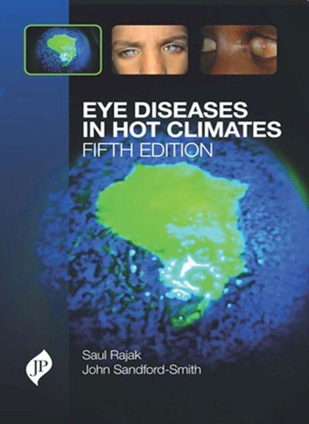 Eye Diseases in Hot Climates, 5th Edition by Saul N. Rajak - ISBN: 9781909836228
