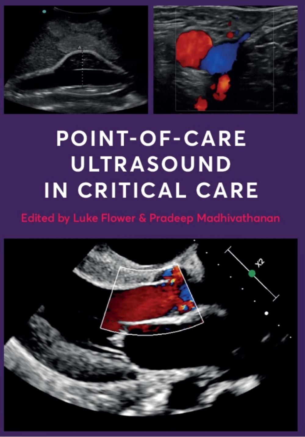 Point-of-Care Ultrasound in Critical Care, 9781911510994