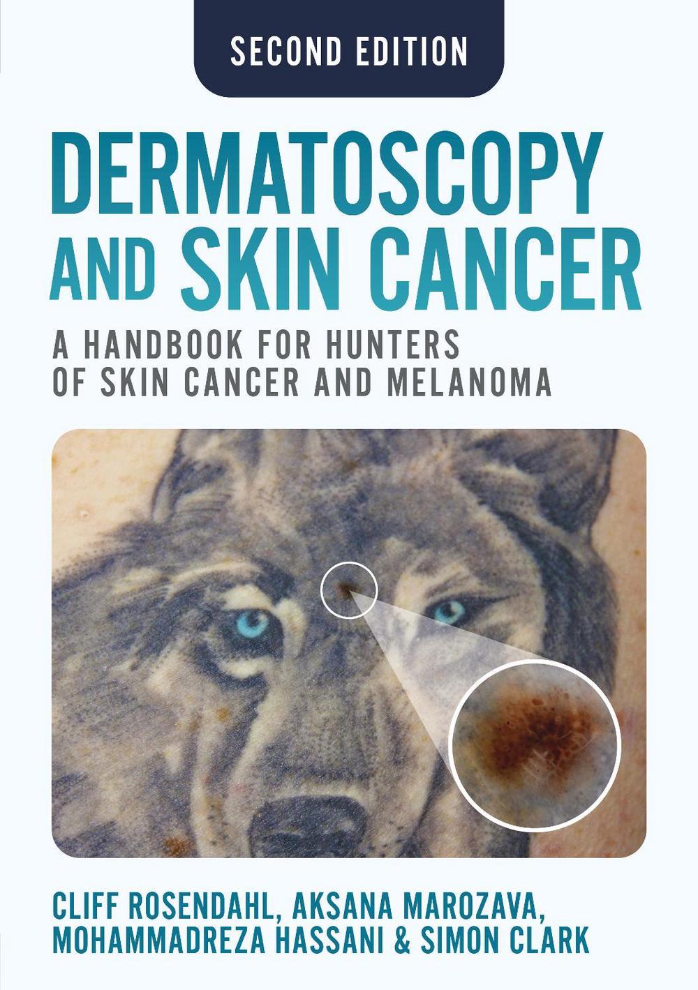 Dermatoscopy and Skin Cancer, second edition, 9781914961670