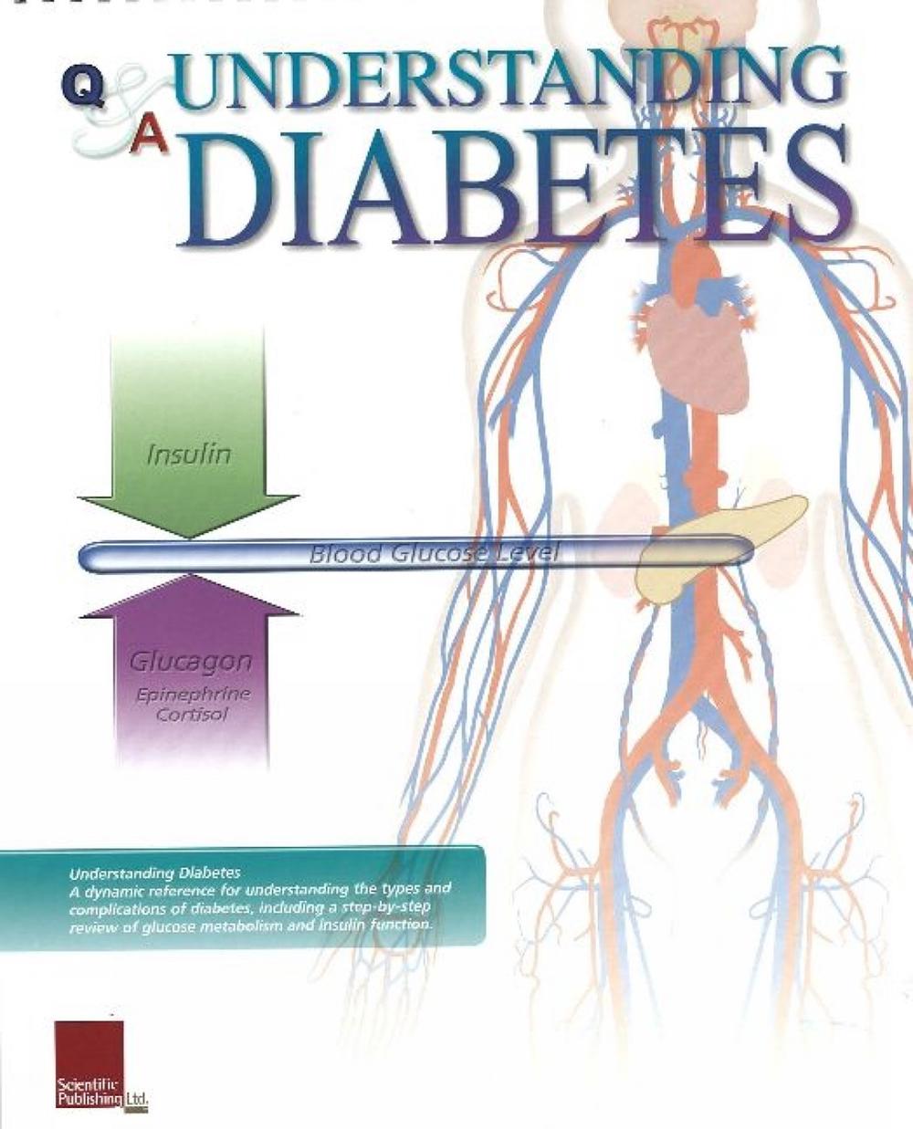 Understanding Diabetes Flip Chart by Scientific Publishing, Spiral