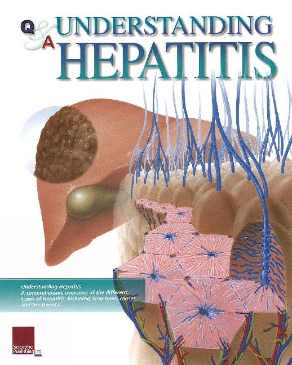 Understanding Hepatitis Flip Chart, 9781932922349