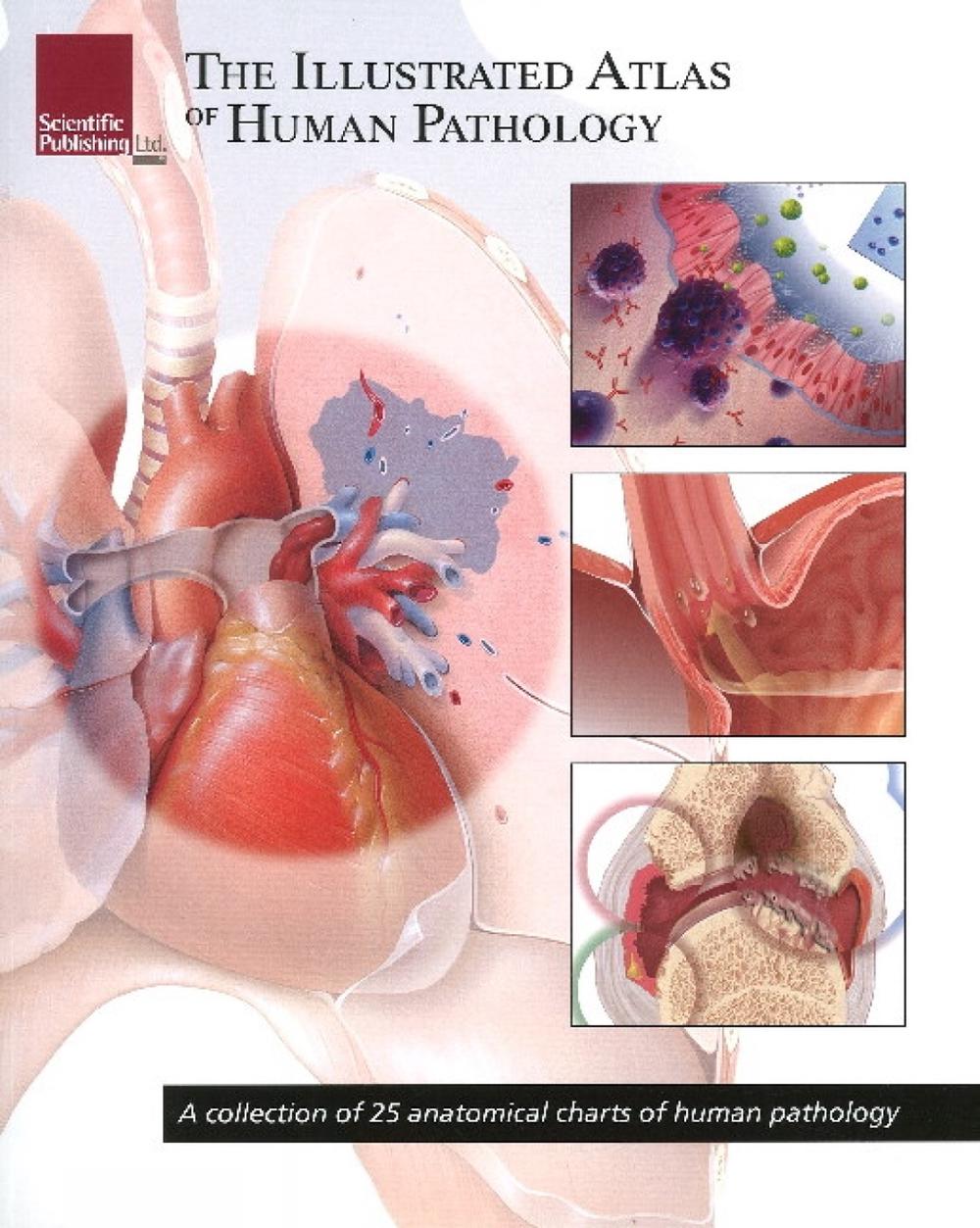 A Collection of 25 Anatomical Charts of Human Pathology, 9781932922998