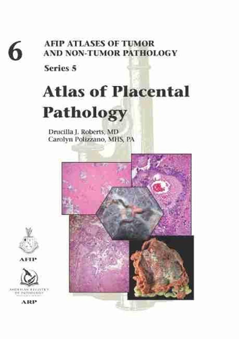 Atlas of Placental Pathology, 9781933477091