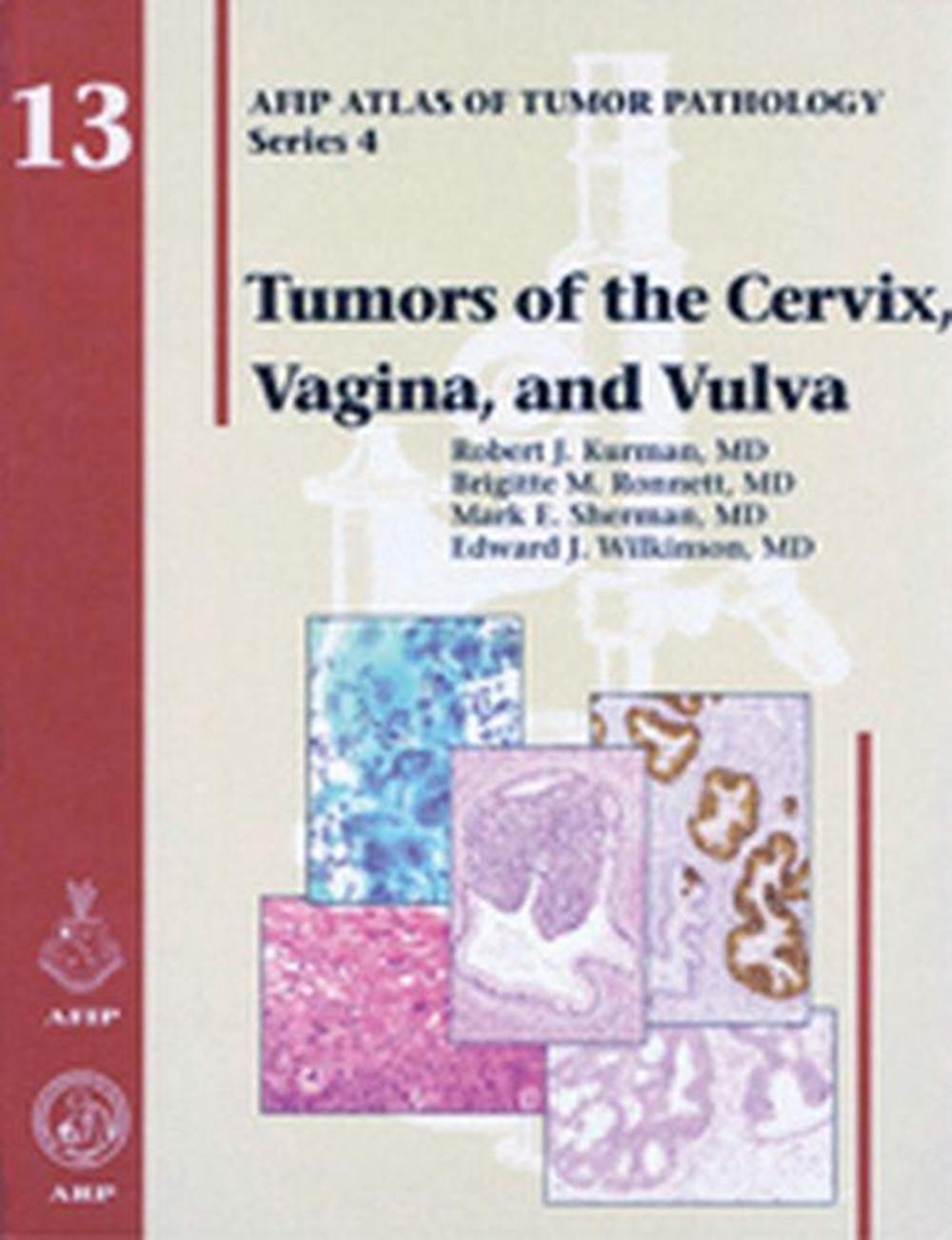Tumors of the Cervix, Vagina, and Vulva, 9781933477114