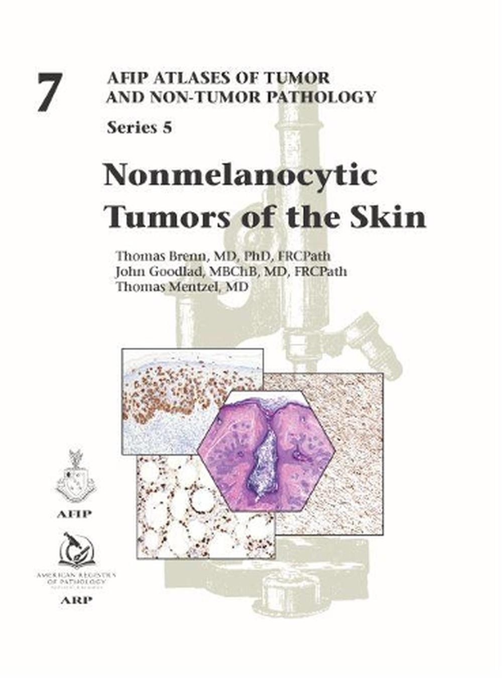 Nonmelanocytic Tumors of the Skin, 9781933477121