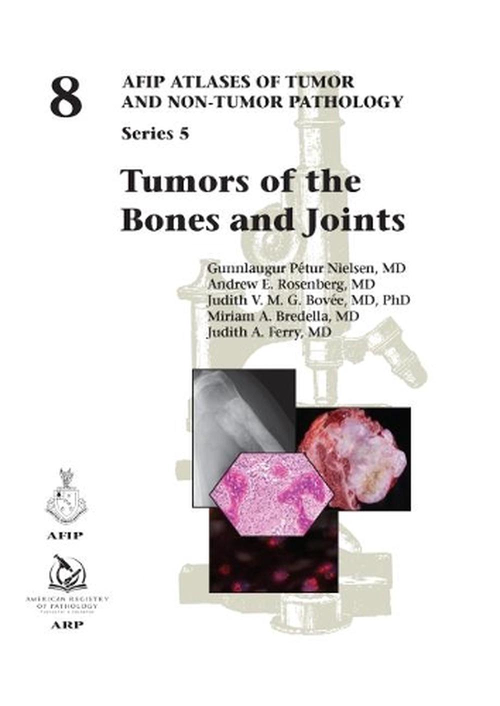 Tumors of the Bones and Joints, 9781933477138