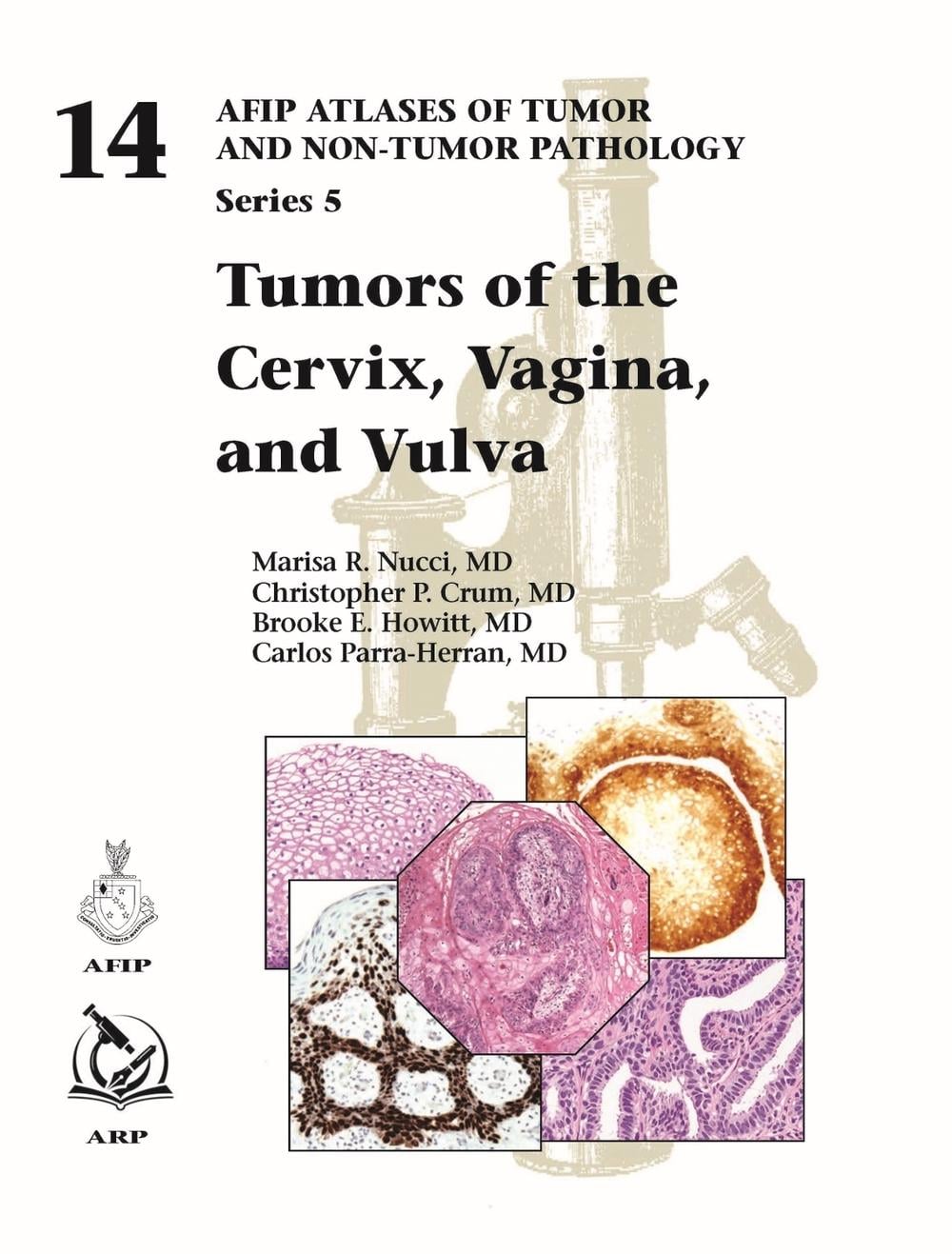 Tumors Of The Cervix Vagina And Vulva By Marisa R Nucci Hardcover tumors-of-the-cervix-vagina-and-vulva-by-marisa-r-nucci-hardcover
