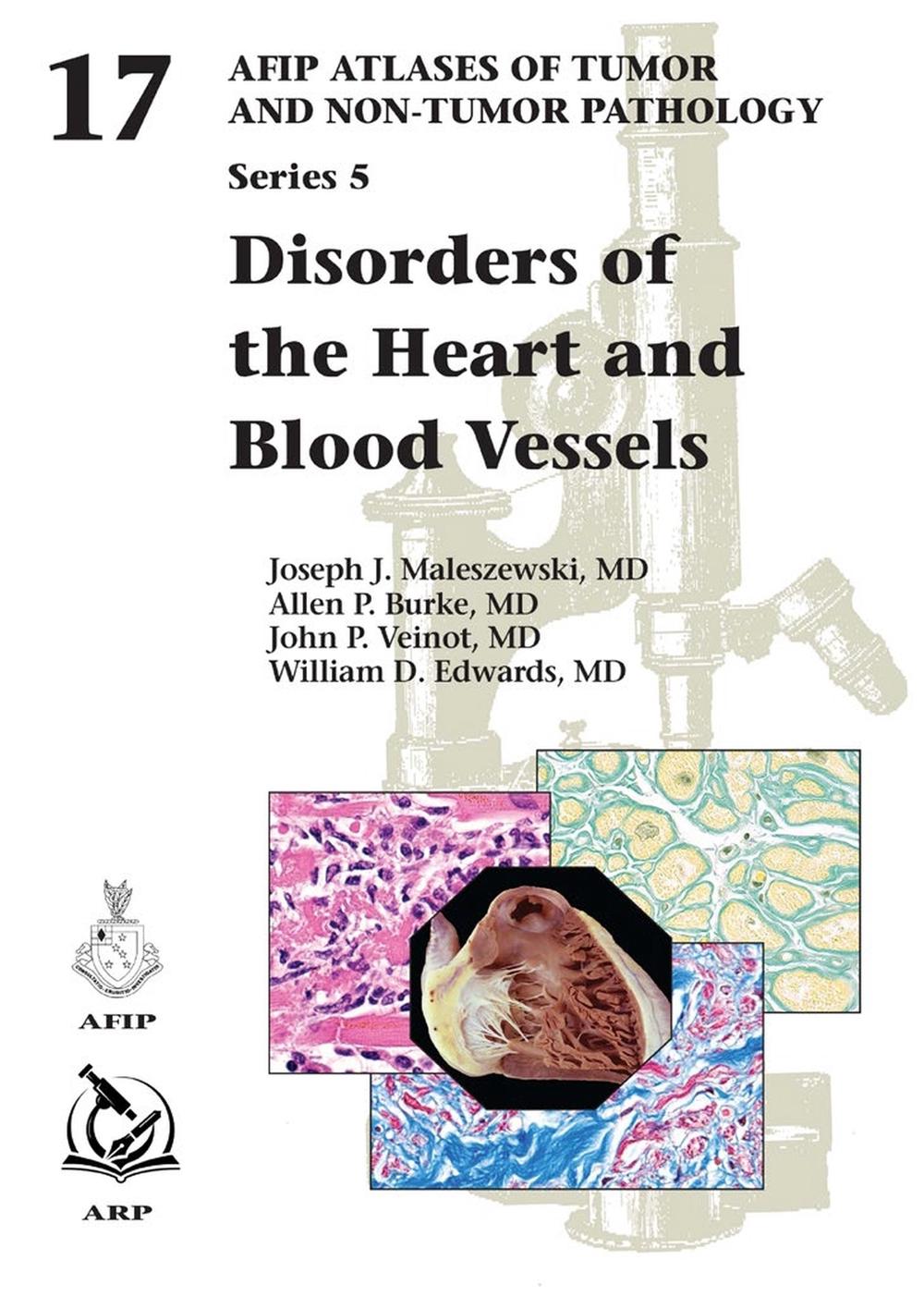 Disorders of the Heart and Blood Vessels, 9781933477299