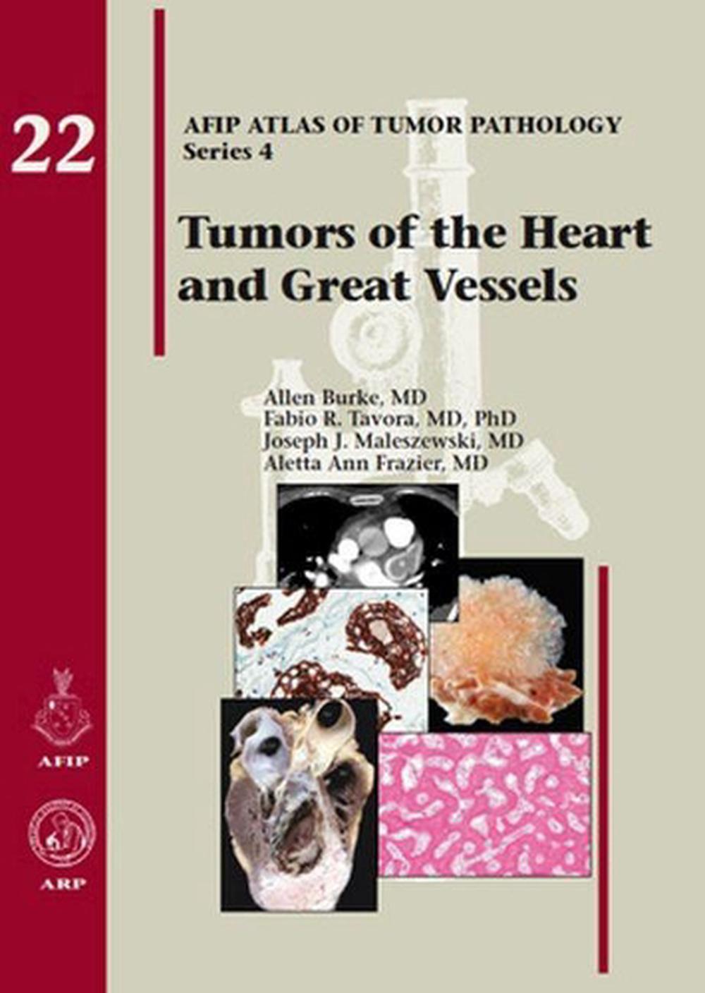 Tumors of the Heart and Great Vessels, 9781933477336