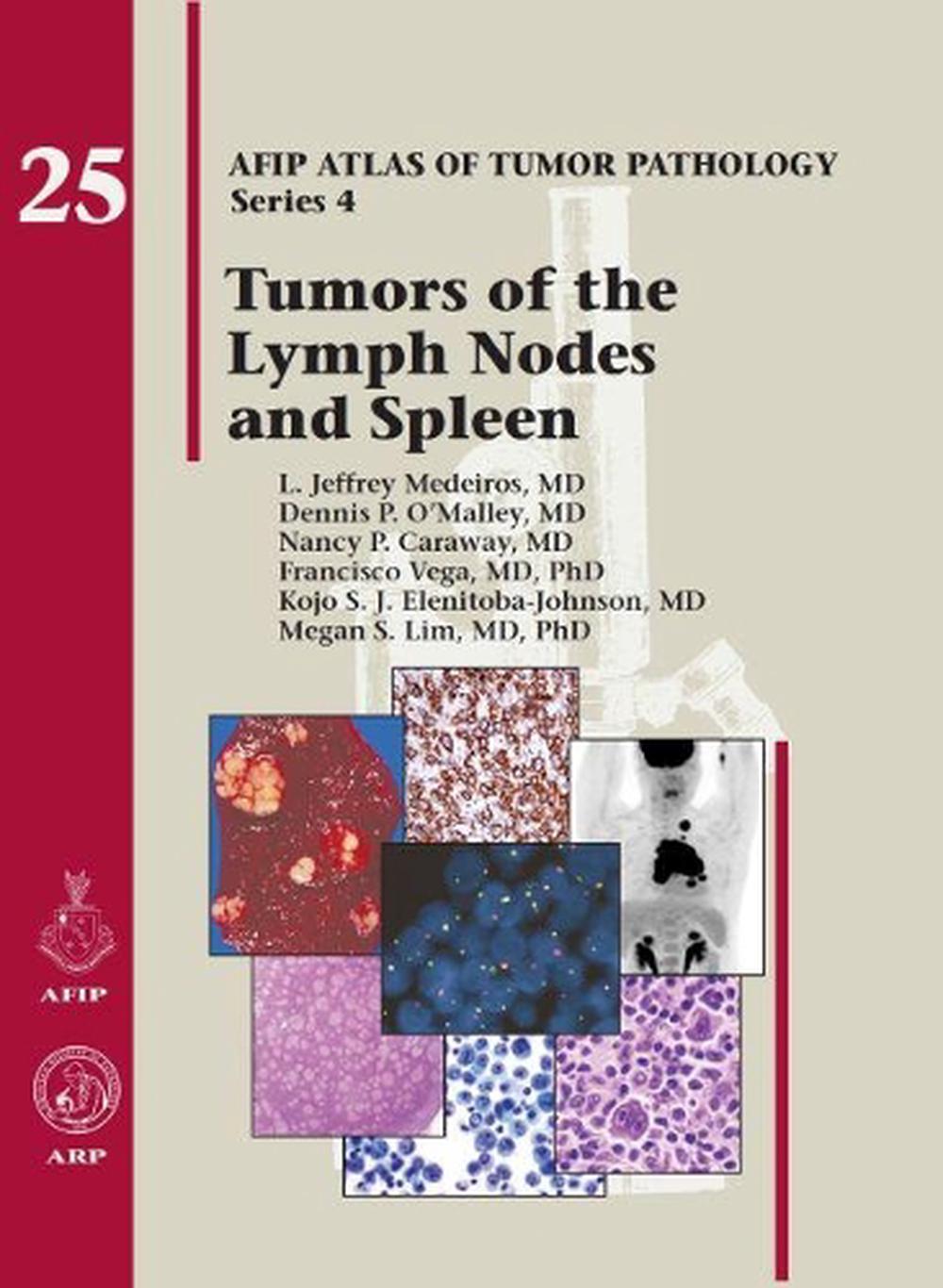 Tumors of the Lymph Nodes and Spleen, 9781933477381