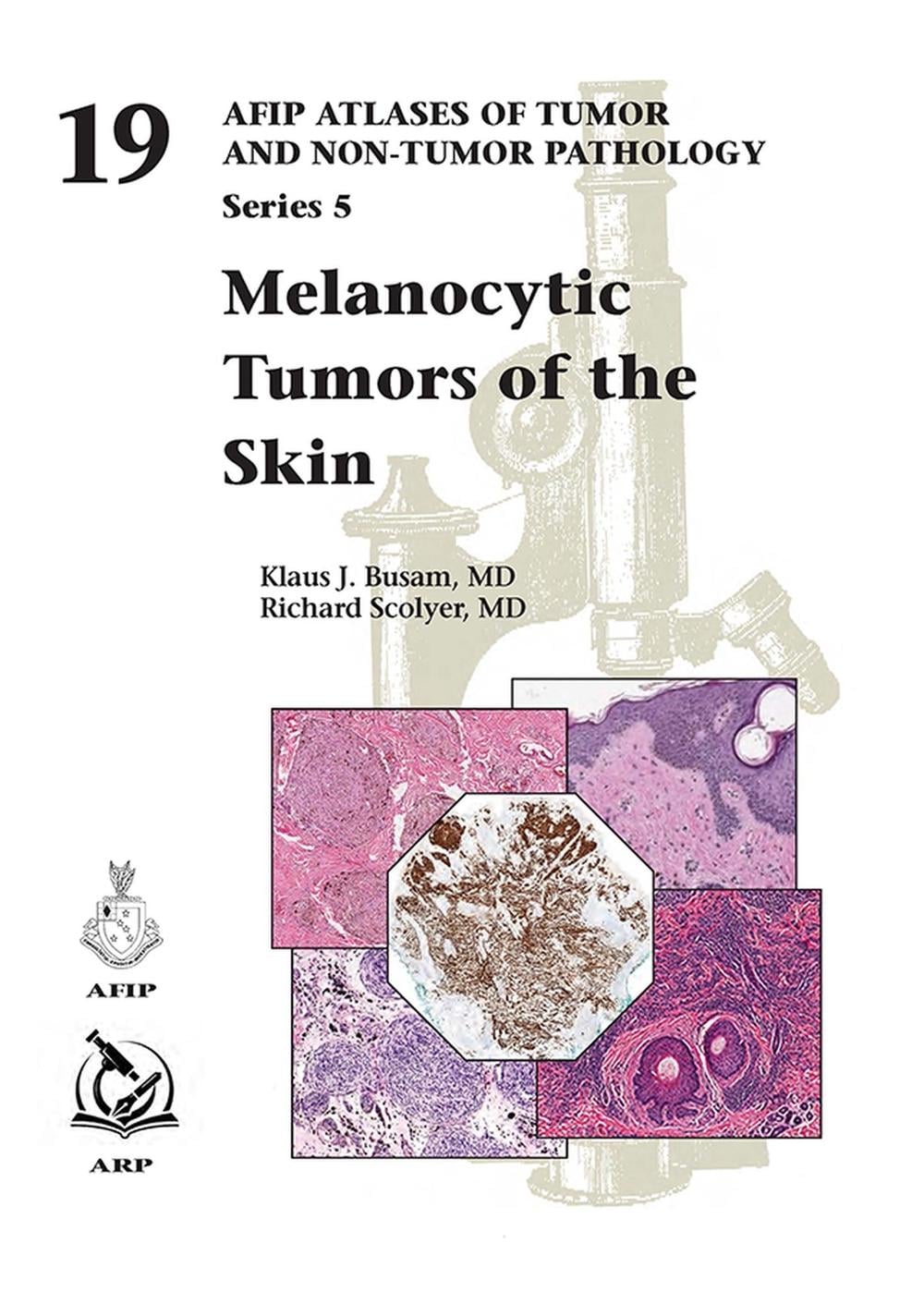 Melanocytic Tumors of the Skin by Klaus J. Busam - ISBN: 9781933477428